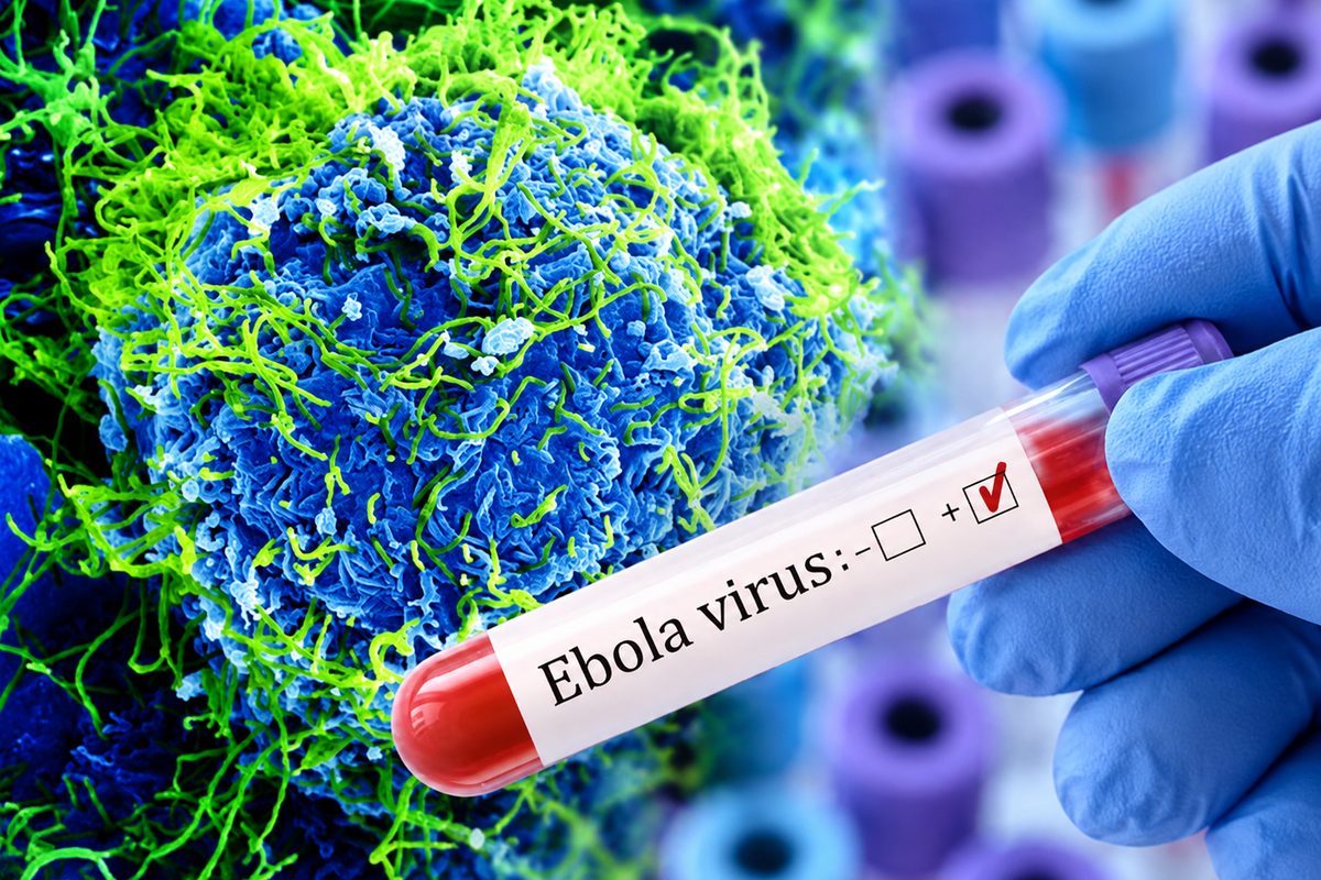 Kenya Confirms First Ebola Case in Nairobi